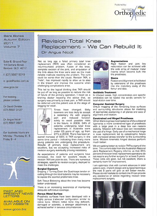 Arthroscopic Rtator Cuff Repair